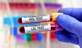每天喝这个，你的胆固醇会很好测试结果甚至会让你的医生感到惊讶